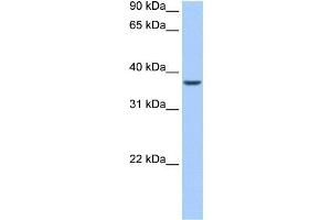 ALKBH8 antibody used at 0. (ALKBH8 anticorps)