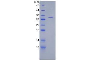SDS-PAGE analysis of Human HSPG2 Protein. (HSPG2 Protéine)