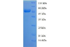 Myelin Basic Protein (MBP) (AA 134-304), (partial) protein (GST tag)