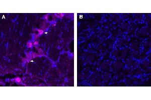 Frozen DRG sections from a paraformaldehyde-perfused rat were incubated with Anti-TRPV1 (VR1)-ATTO  Antibody (ABIN7581996, 1:100, magenta).
