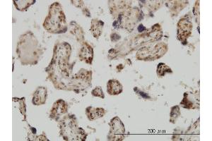 Immunoperoxidase of monoclonal antibody to MED31 on formalin-fixed paraffin-embedded human placenta.