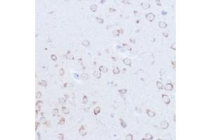 Immunohistochemistry of paraffin-embedded mouse brain using SSR2 Rabbit pAb (ABIN7270299) at dilution of 1:100 (40x lens).