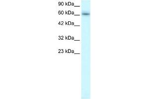 WB Suggested Anti-TRAFD1 Antibody Titration:  0. (TRAFD1 anticorps  (C-Term))