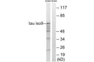 Western blot analysis of extracts from rat brain cells, using Tau (Ab-717/400) antibody. (MAPT anticorps  (Ser400, Ser717))
