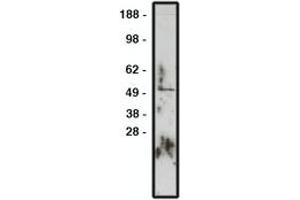Image no. 1 for anti-Zinc Finger Protein GLI1 (GLI1) antibody (ABIN793725) (GLI1 anticorps)