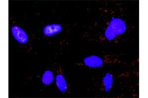 Proximity Ligation Analysis of protein-protein interactions between TP53 and MAPK1.