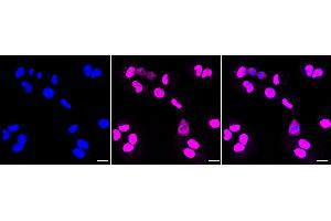 Immunocytochemical staining of HT- cells with Phospho-AKT1 (T450) antibody (ABIN7800786), 1:1,000).