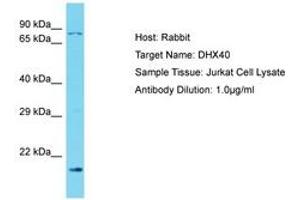 Image no. 1 for anti-DEAH (Asp-Glu-Ala-His) Box Polypeptide 40 (DHX40) (N-Term) antibody (ABIN6750559) (DEAH (Asp-Glu-Ala-His) Box Polypeptide 40 (DHX40) (N-Term) anticorps)