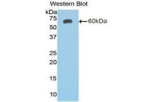 Western blot analysis of the recombinant protein. (IGFBP2 anticorps  (AA 24-305))