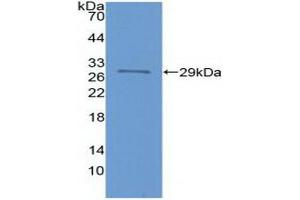 Detection of Recombinant FOXP3, Human using Polyclonal Antibody to Forkhead Box P3 (FOXP3) (FOXP3 anticorps  (AA 191-412))