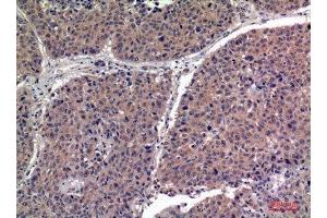 Immunohistochemistry (IHC) analysis of paraffin-embedded Human Lung, antibody was diluted at 1:100. (IGFBPI anticorps  (Internal Region))