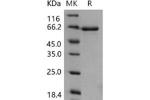 Western Blotting (WB) image for EPH Receptor B3 (EPHB3) (Active) protein (His tag) (ABIN7195552)
