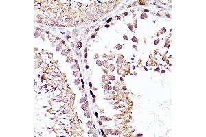 Immunohistochemistry of paraffin-embedded Rat testis using S antibody (ABIN7270138) at dilution of 1:200 (40x lens).