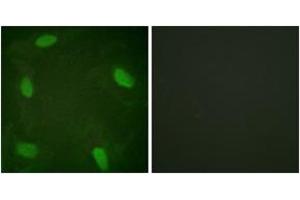 Immunofluorescence analysis of HeLa cells treated with Forskolin 40nM 30', using SSB (Phospho-Ser366) Antibody. (SSB anticorps  (pSer366))