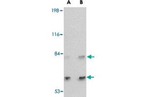 Western blot analysis of SATB2 in A-20 cell lysate with SATB2 polyclonal antibody  at (A) 2 and (B) 4 ug/mL . (SATB2 anticorps  (C-Term))