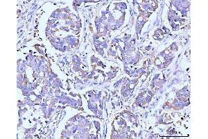 IHC analysis of ITCH/AIP4 using anti-ITCH/AIP4 antibody (ABIN7600263). (ITCH anticorps  (AA 17-358))