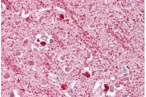 Anti-DAP3 antibody IHC staining of human brain, cortex. (DAP3 anticorps  (AA 387-398))