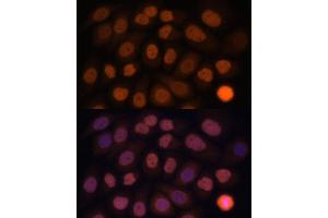 Immunofluorescence analysis of HeLa cells using KLF6 antibody (ABIN6131578, ABIN6142923, ABIN6142924 and ABIN6214111) at dilution of 1:100. (KLF6 anticorps  (AA 40-200))