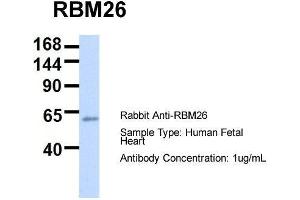 Host:  Rabbit  Target Name:  RBM26  Sample Type:  Human Fetal Heart  Antibody Dilution:  1. (RBM26 anticorps  (Middle Region))