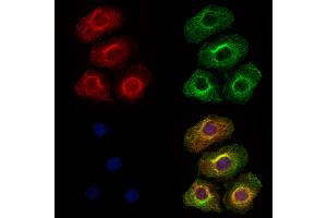 ABIN6264963 and ABIN6273315 staining Hela cells by IF/ICC. (SEC63 anticorps  (C-Term))