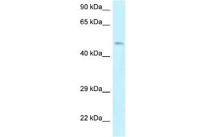 WB Suggested Anti-EPB49 Antibody Titration: 1. (Dematin anticorps  (Middle Region))