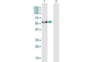 Western Blot analysis of KRT39 expression in transfected 293T cell line by KRT39 MaxPab polyclonal antibody.