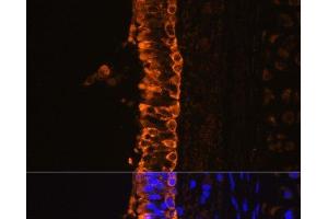Immunofluorescence analysis of Rat bronchus cells using KRT7 Polyclonal Antibody at dilution of 1:100. (Cytokeratin 7 anticorps)