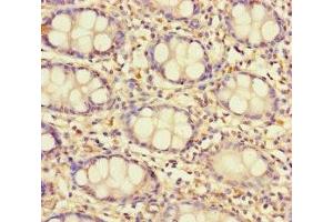 Immunohistochemistry of paraffin-embedded human colon tissue using ABIN7171536 at dilution of 1:100 (TAS2R13 anticorps  (AA 150-184))