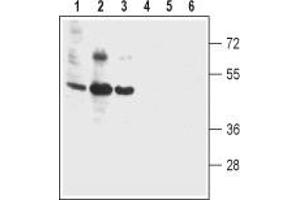 Western blot analysis of human colon cancer cell lines Colo-205 (lanes 1 and 4), human T-84 colonic adenocarcinoma cell line (lanes 2 and 5) and human colon cancer HT-29 cell line (lanes 3 and 6): - 1-3. (Bestrophin 2 anticorps  (3rd Extracellular Loop))