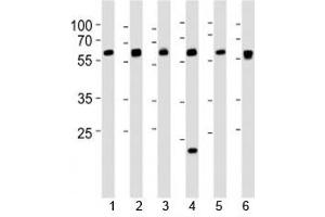 Western blot analysis of lysate from 1) 293, 2) HepG2, 3) HUVEC, 4) Raji, 5) rat C6 and 6) mouse C2C12 cell line using SPHK1 antibody at 1:1000.