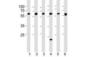 Western blot analysis of lysate from 1) 293, 2) HepG2, 3) HUVEC, 4) Raji, 5) rat C6 and 6) mouse C2C12 cell line using SPHK1 antibody at 1:1000. (SPHK1 anticorps  (AA 286-315))