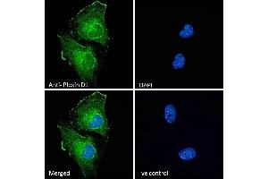 (ABIN185358) Immunofluorescence analysis of paraformaldehyde fixed U251 cells, permeabilized with 0. (PLXND1 anticorps  (Internal Region))