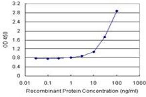 ANXA5 (Human) Matched Antibody Pair
