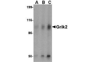 Western blot analysis of Grik2 in human brain tissue lysate with AP30382PU-N Grik2 antibody at (A) 0. (GRIK2 anticorps  (C-Term))