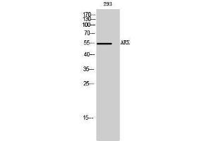 Western Blotting (WB) image for anti-Aristaless Related Homeobox (ARX) (Internal Region) antibody (ABIN3180497)