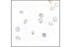 Immunocytochemistry of ORAI2 in Jurkat cells with this product at 5 μg/ml.