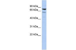 WB Suggested Anti-C1orf103 Antibody Titration: 0. (C1orf103 anticorps  (Middle Region))
