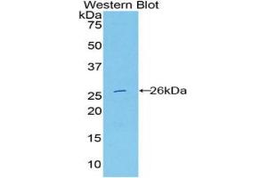 Western blot analysis of the recombinant protein. (DNASE1L2 anticorps  (AA 32-229))