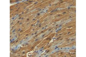 Used in DAB staining on fromalin fixed paraffin- embedded heart tissue (ANKRD1 anticorps  (AA 6-291))