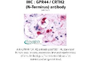 Image no. 1 for anti-Prostaglandin D2 Receptor 2 (PTGDR2) (Extracellular Domain), (N-Term) antibody (ABIN1735101)