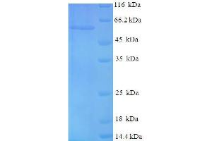 SDS-PAGE (SDS) image for Tumor Protein P53 (TP53) (AA 2-393) protein (His-SUMO Tag) (ABIN5710530)