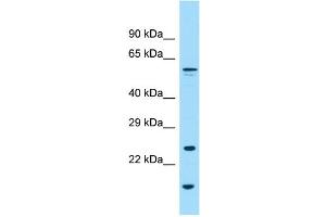 WB Suggested Anti-GPC6 Antibody Titration: 1. (Glypican 6 anticorps  (N-Term))