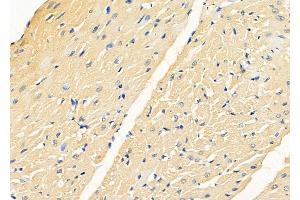 ABIN6262847 and ABIN6278586 at 1/100 staining Rat heart tissue by IHC-P. (KLHL3 anticorps  (N-Term))