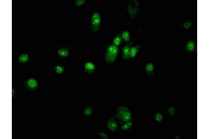Immunofluorescence staining of MCF-7 cells with ABIN7162500 at 1:133, counter-stained with DAPI.