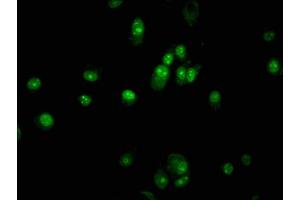 Immunofluorescence staining of MCF-7 cells with ABIN7162500 at 1:133, counter-stained with DAPI. (PAX5 anticorps  (AA 362-391))