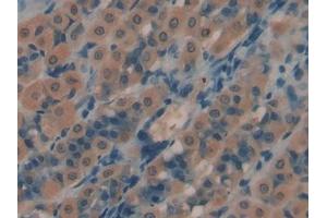 DAB staining on IHC-P; Samples: Rat Intestine Tissue (PROS1 anticorps  (AA 416-646))