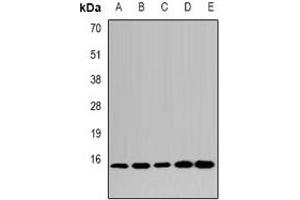 Western blot analysis of LSm4 expression in HepG2 (A), MCF7 (B), mouse kidney (C), mouse heart (D), rat liver (E) whole cell lysates. (LSM4 anticorps)