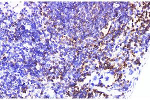 Immunohistochemistry of paraffin-embedded Mouse spleen using IL6R Polyclonal Antibody at dilution of 1:200 (IL-6 Receptor anticorps)
