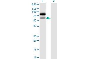 Western Blot analysis of TRMT2A expression in transfected 293T cell line by TRMT2A monoclonal antibody (M02), clone 4C10-1A11. (TRMT2A anticorps  (AA 1-625))