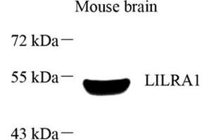 Western blot analysis of LILRA1 (ABIN7074490),at dilution of 1: 1000